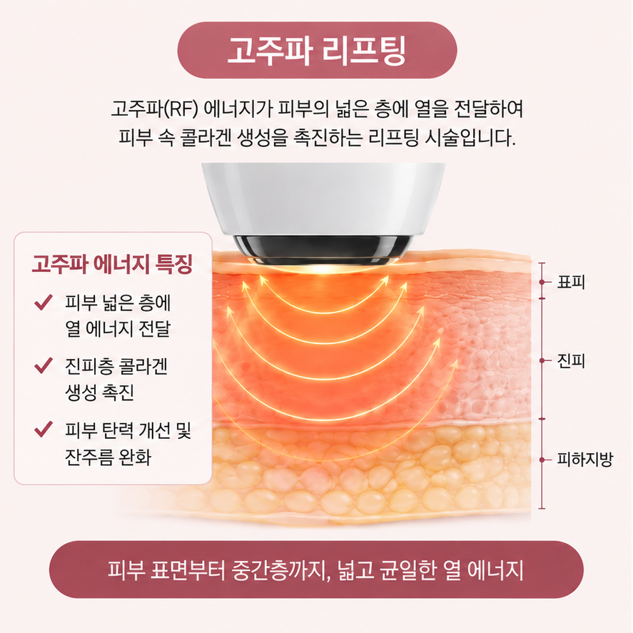 고주파의 작용 원리 콜라겐 리모델링